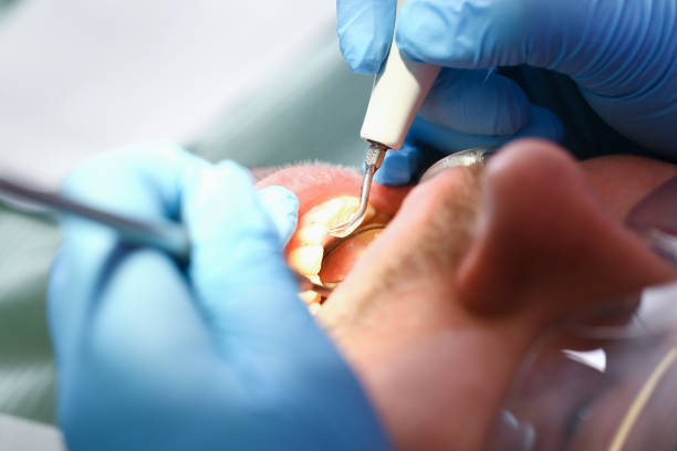 Best Emergency Root Canal Treatment in Perryville, AR