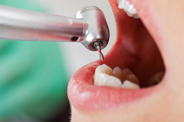  Perryville, AR Emergency Dentist Pros